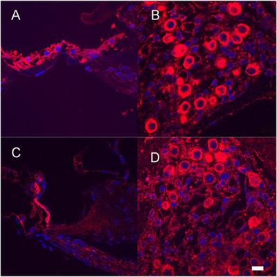 Improving Control of Gene Therapy-Based Neurotrophin Delivery for Inner Ear Applications